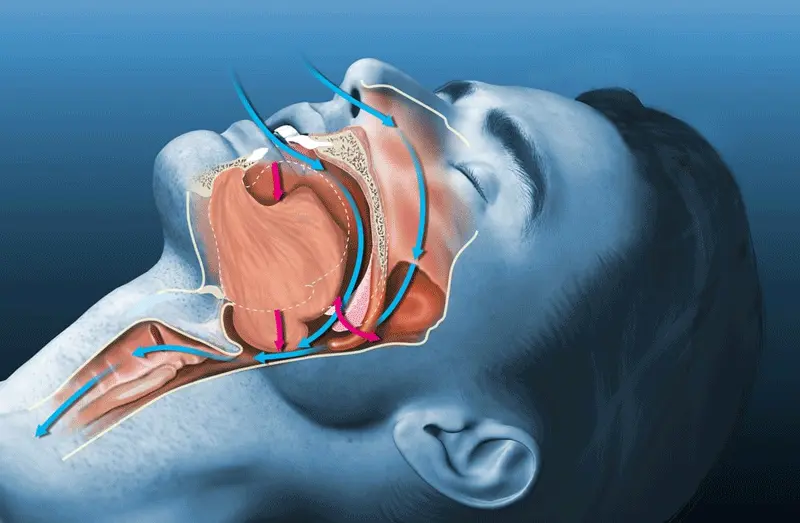 science about snoring