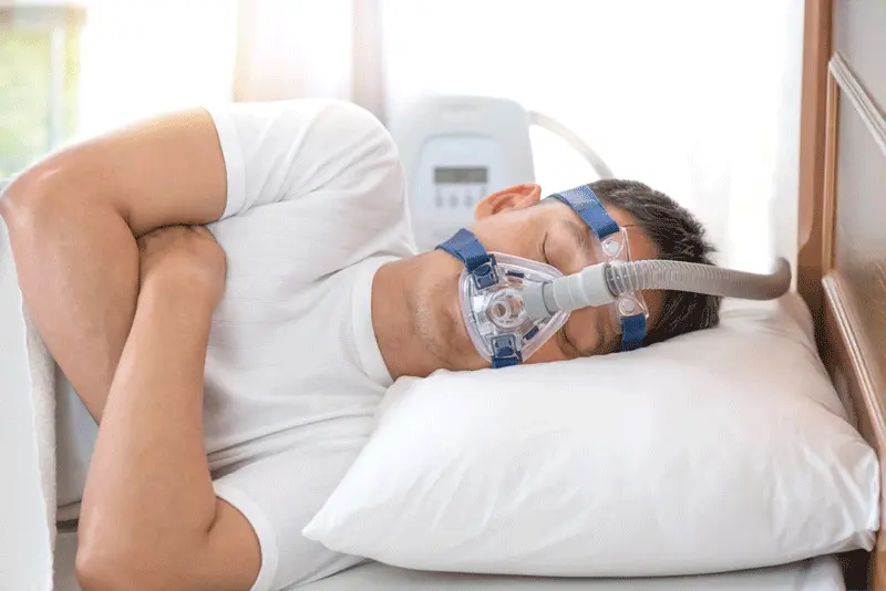  non-surgical for snoring