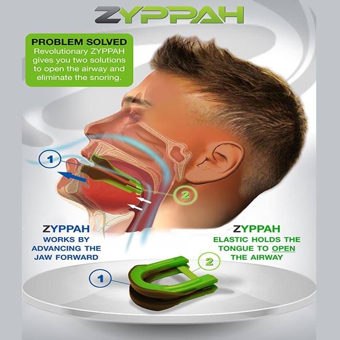 Medical diagram of how zyppah works.